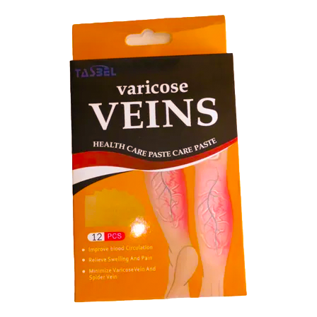 Varicose Veins